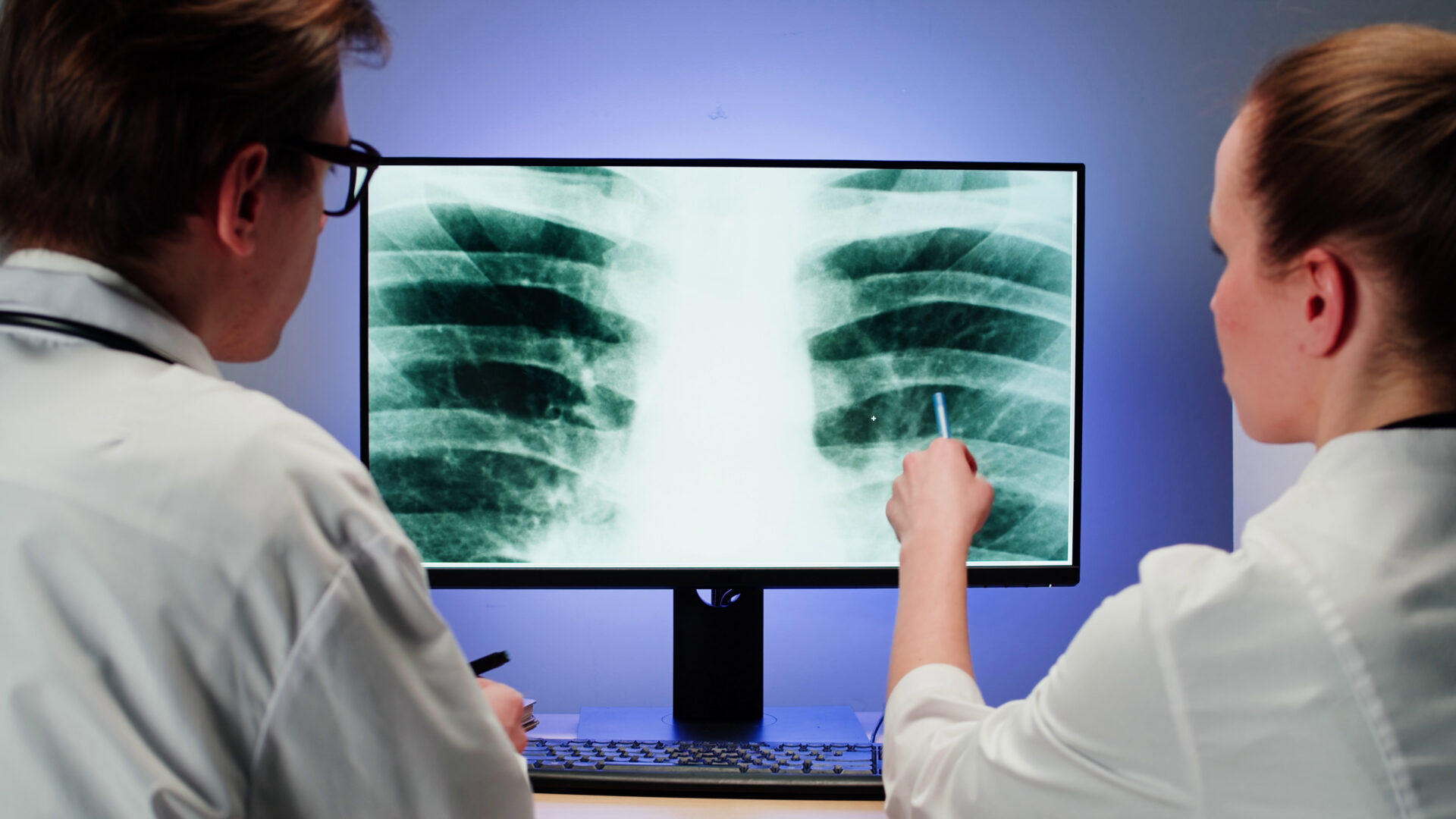 Doctors analyzing a chest X-ray scan for medical diagnosis