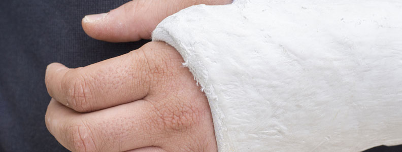 Close up of a hand in a cast.