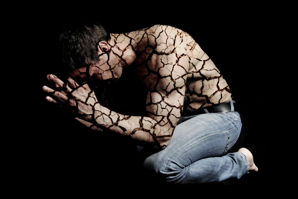Person in pain with cracked skin after injury, symbolizing pain and suffering.